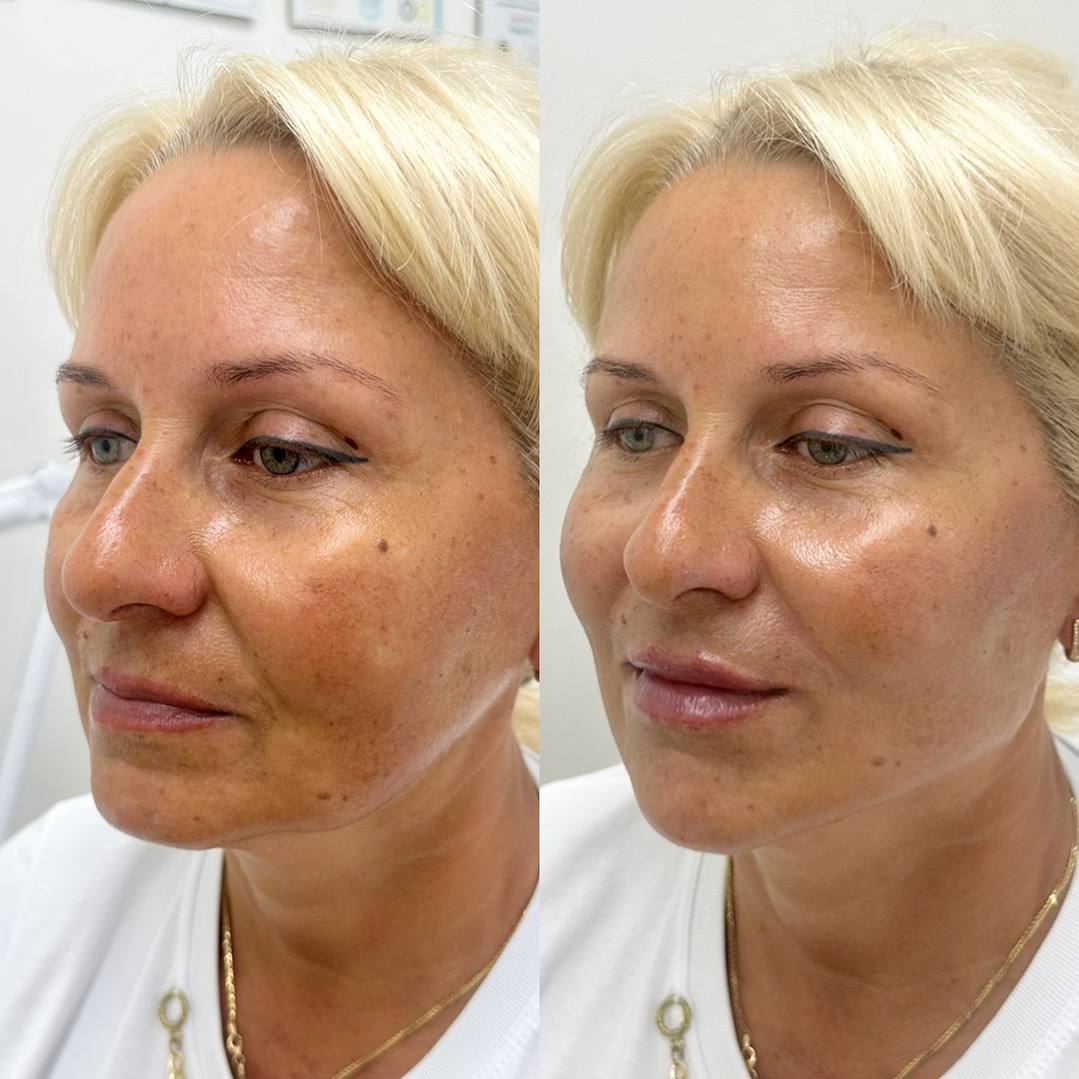 Full Face