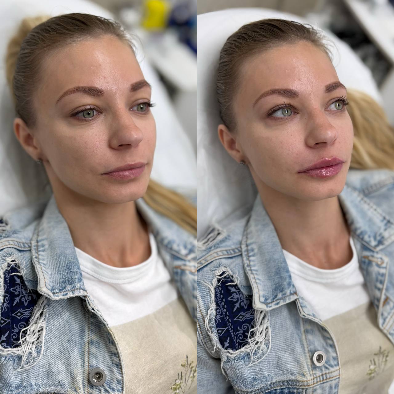 Результат до и после
